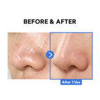 Hydro Boost Enzyme Cleansing Balm