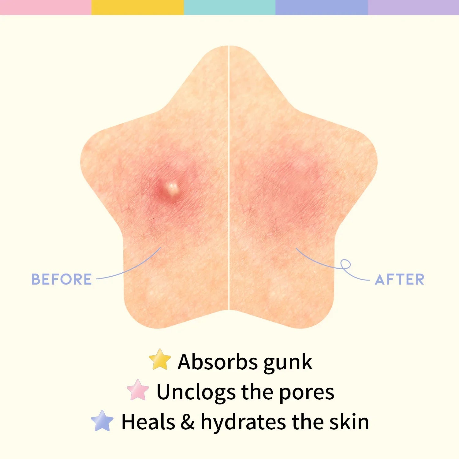 Hydrocolloid Blemish Care Star Spot Patch