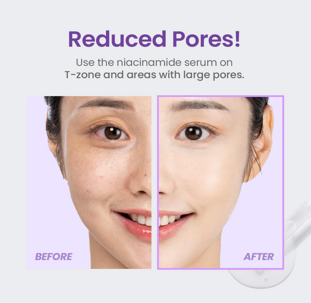 Niacinamide 20% Serum