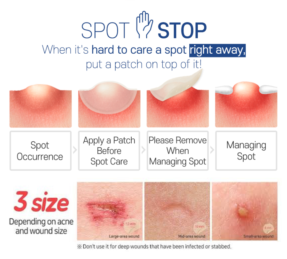 Witch Piggy Hell-Pore Blemish Spot Patch (44 patches)