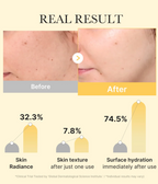 Kojic Acid Turmeric Brightening Gold Gel Mask