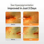 Glutathiosome Dark Spot Serum Vita drop