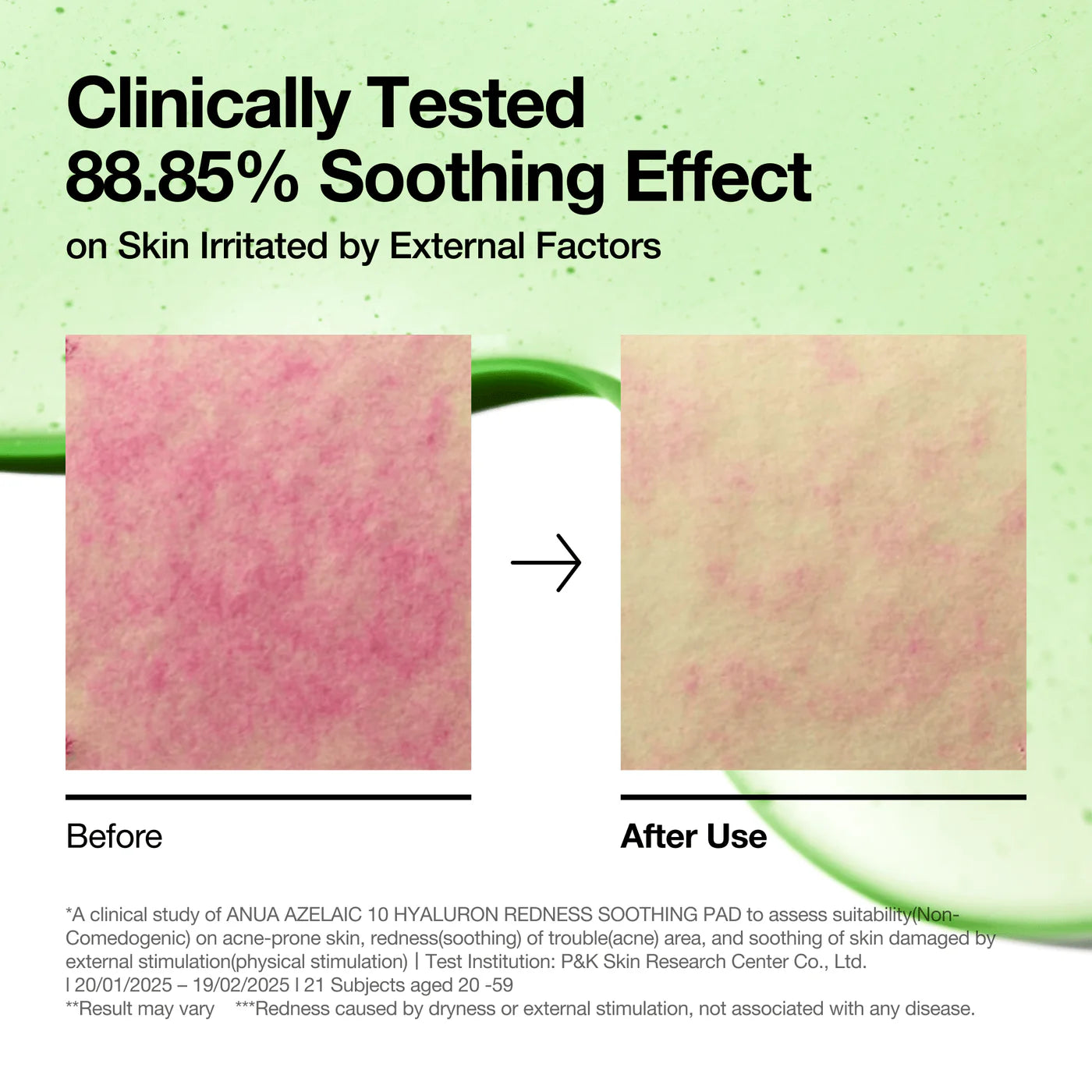 Soothing Pad Azelaic 10 + Hyaluron