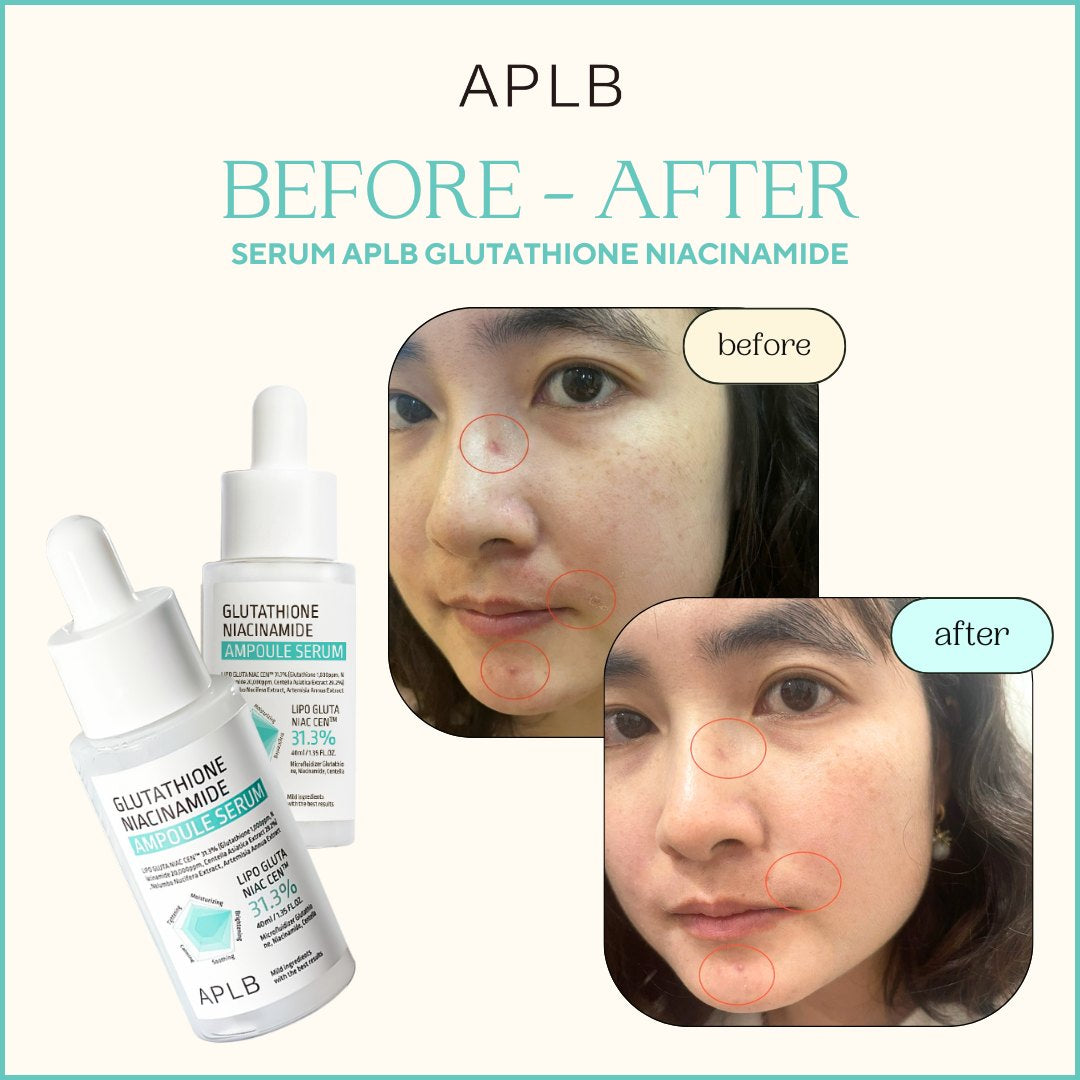 Glutathione Niacinamide Ampoule Serum