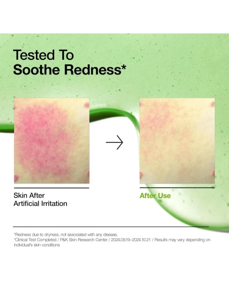 Azelaic Acid 10 Hyaluron Redness Soothing Serum