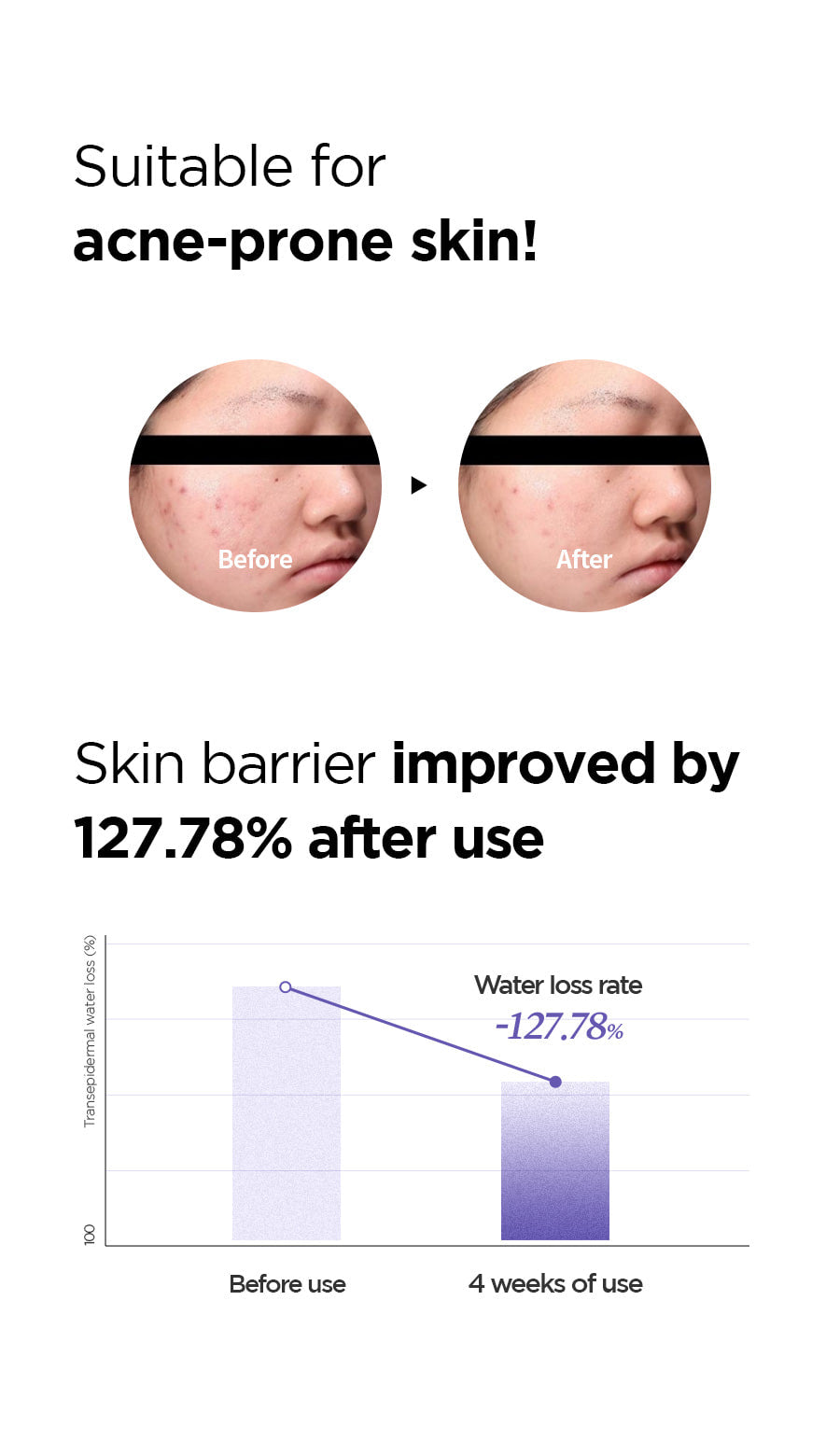 Onion Newpair B5 Ampoule